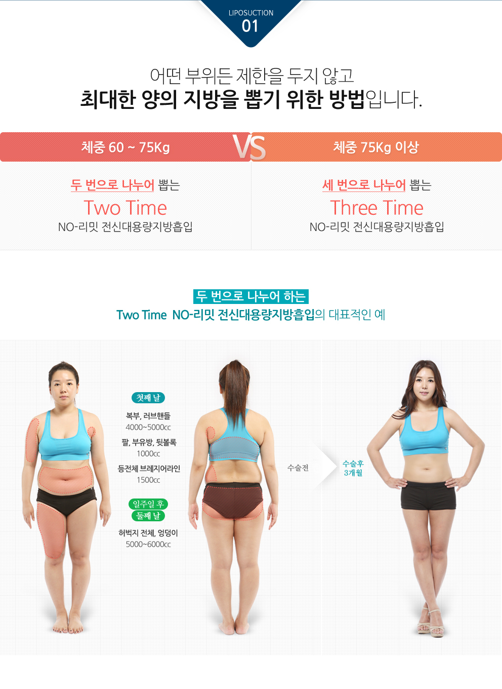 대용량지방흡입7