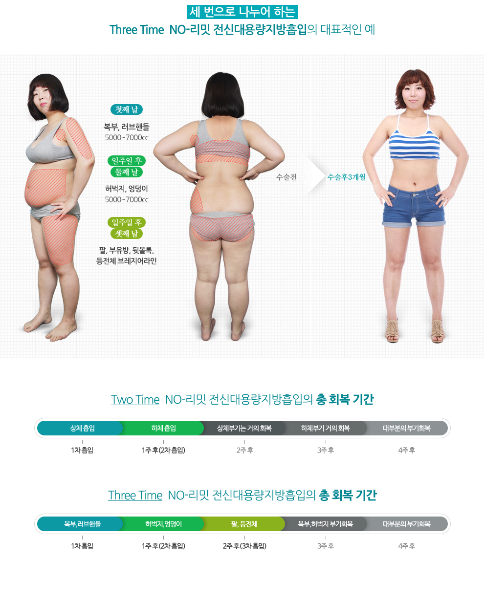 대용량지방흡입8
