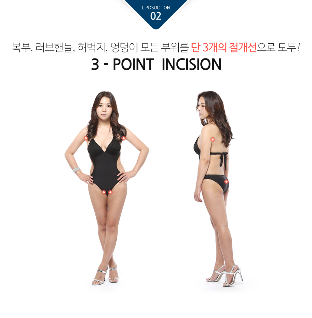 대용량지방흡입9